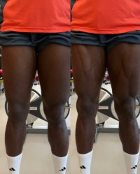 开云登录入口地址-重伤归来！阿方索晒照自己腿部的变化，轻松练出肌肉